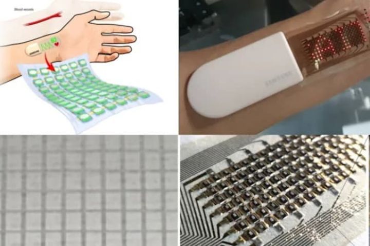 “Samsung” şirkəti tibb sahəsində yeniliyə imza atıb